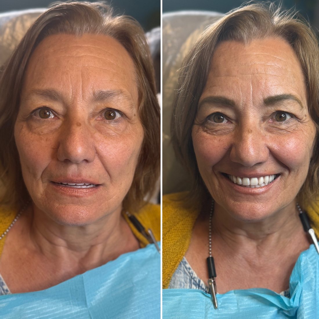 Permanent eyebrows before and after on a mature client with sparse brows and deep lines