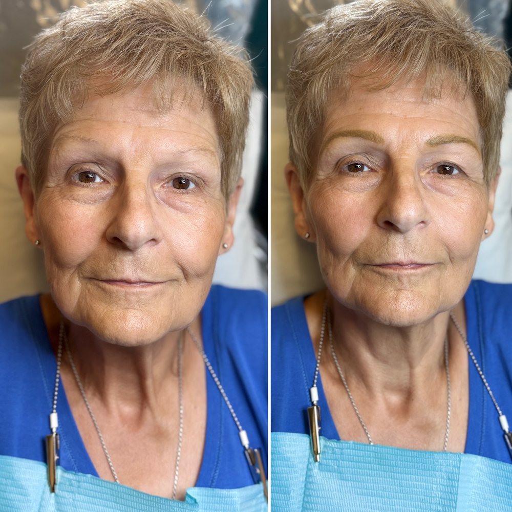 Permanent eyebrows before and after on a mature client with fine, thin skin